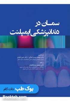 سمان در دندانپزشکی ایمپلنت