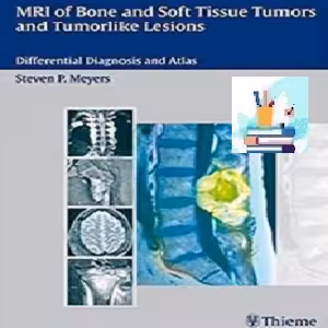 MRI of Bone and Soft Tissue Tumors and Tumorlike Lesions TRU