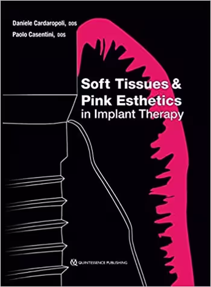 󾕇 دانلود کتاب Soft Tissues And Pink Esthetics In Implant Therapy, 2019 - دانلود کتاب های دانشگاهی