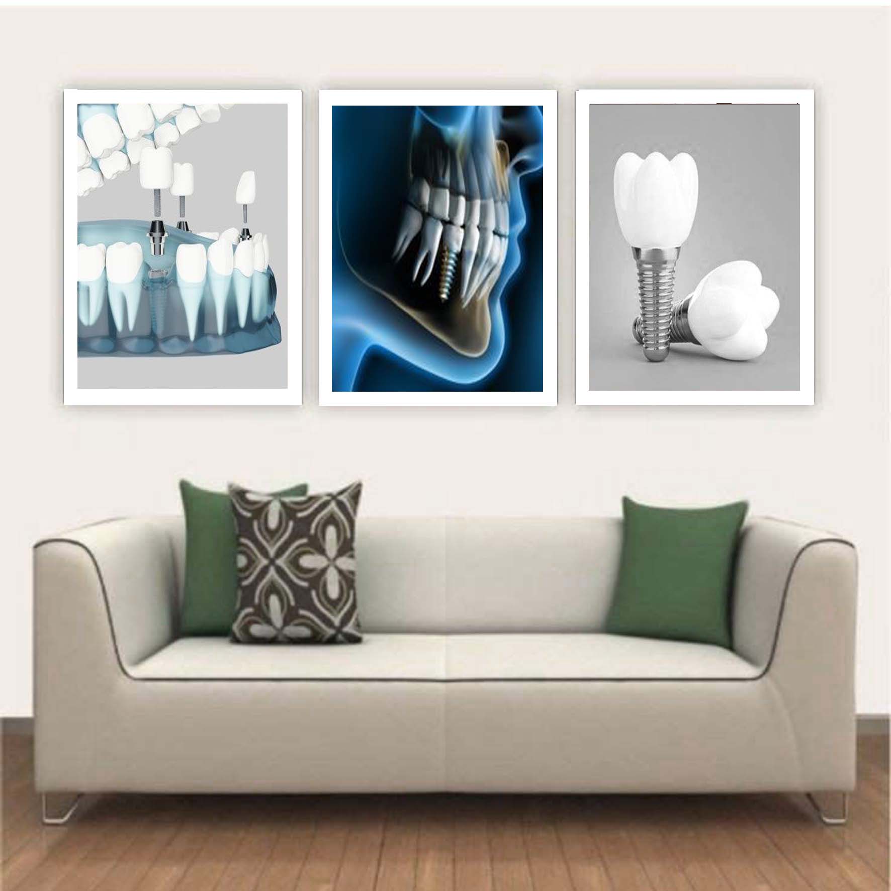 تابلو مدل دندانپزشکی طرح ایمپلنت کد 16 مجموعه 3 عددی