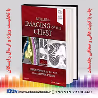 Muller’s Imaging of the Chest 2nd Edition