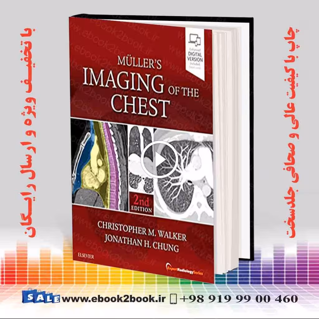 Muller’s Imaging of the Chest 2nd Edition