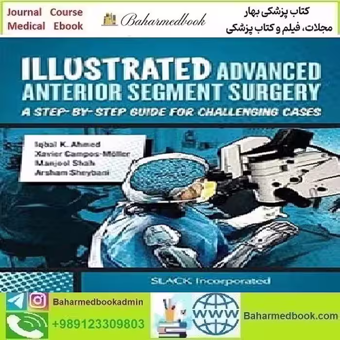 Illustrated Advanced Anterior Segment Surgery 2021