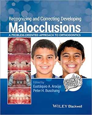 [PDF] دانلود کتاب Recognizing And Correcting Developing Malocclusions - A Problem-Oriented Approach To Orthodontics, 2016