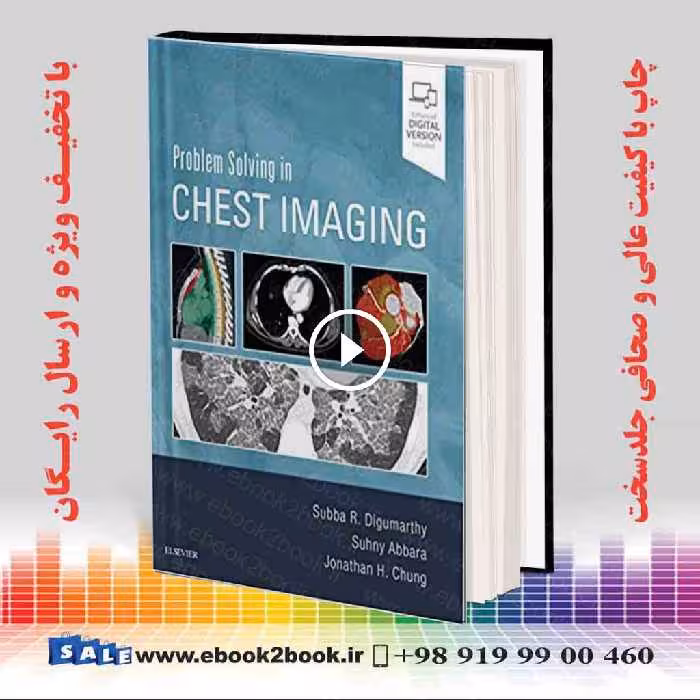 Problem Solving in Chest Imaging