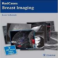 Breast Imaging (RadCases), 1ed - کتاب پزشکی بهار