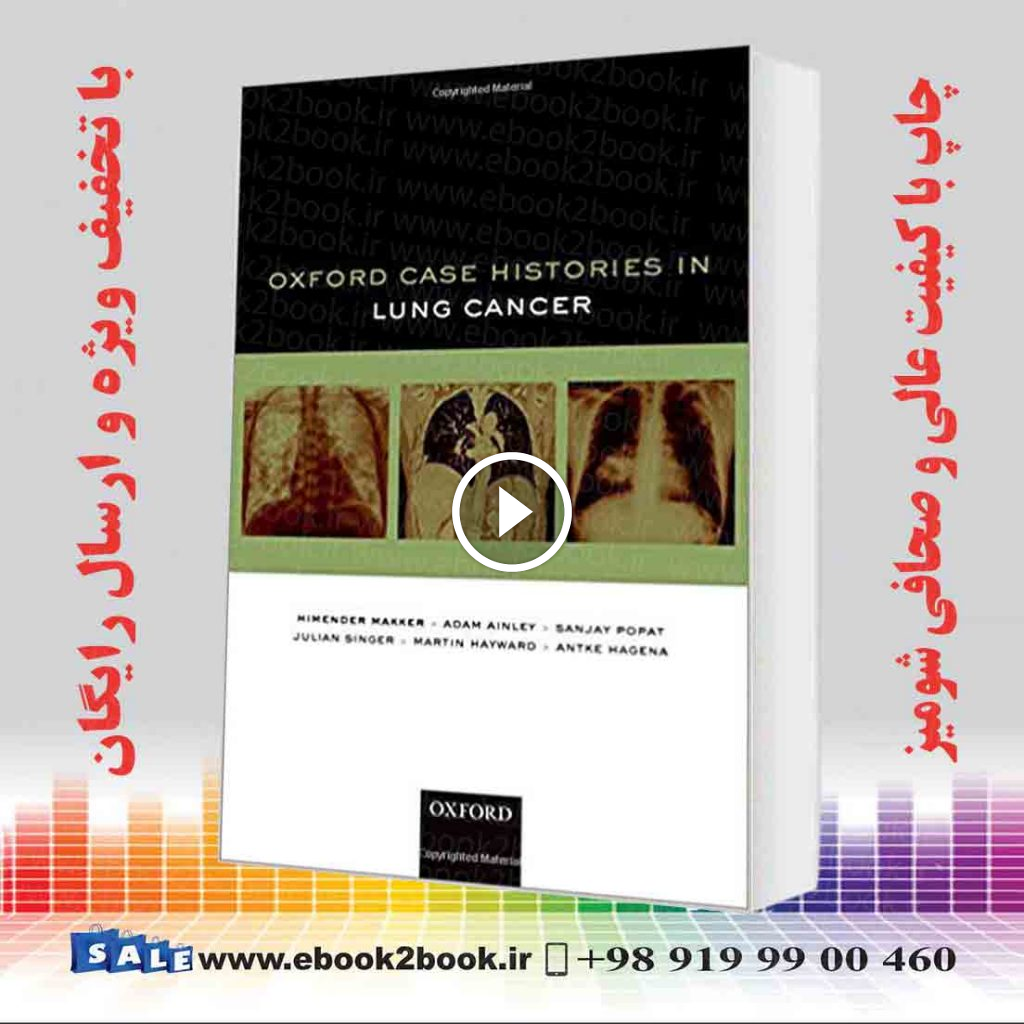 Oxford Case Histories in Lung Cancer