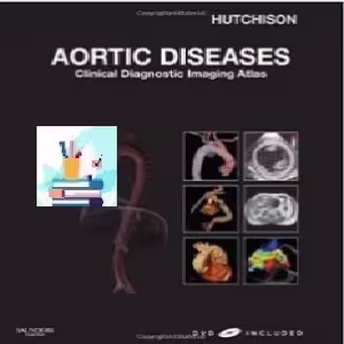 Aortic Diseases TRUE PDF price 1€
