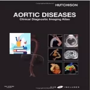 Aortic Diseases TRUE PDF price 1€