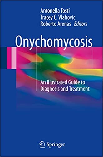  دانلود کتاب Onychomycosis - An Illustrated Guide To Diagnosis And Treatment, 2017 - دانلود کتاب های دانشگاهی