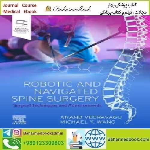 Robotic and Navigated Spine Surgery Surgi