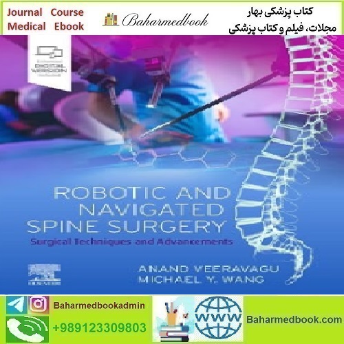 Robotic and Navigated Spine Surgery Surgi