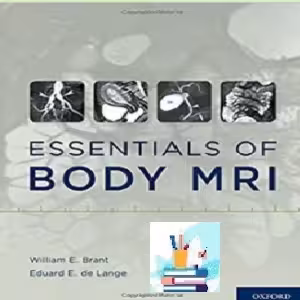 Essentials of Body MRI TRUE PDF price 1€