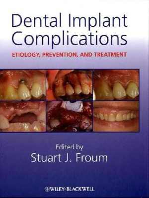 [PDF] دانلود کتاب Dental Implant Complications - Etiology, Prevention, And Treatment, 2010