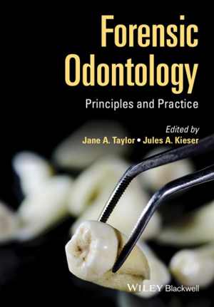 [PDF] دانلود کتاب Forensic Odontology, 2001