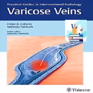 Varicose Veins TRUE PDF price 1€