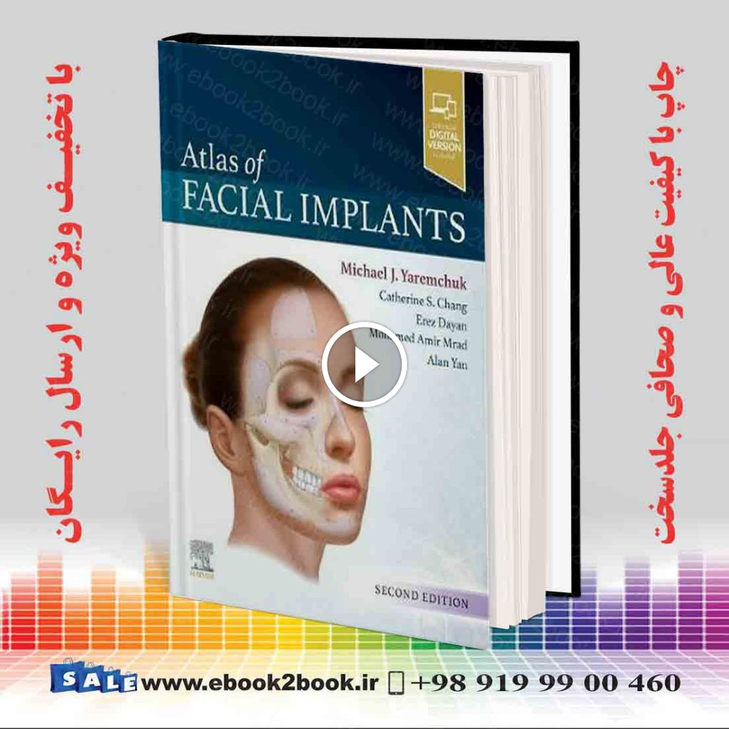 Atlas of Facial Implants