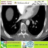 Clinical Cardiopulmonary Imaging Review 2019 video co