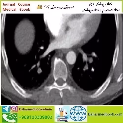 Clinical Cardiopulmonary Imaging Review 2019 video co