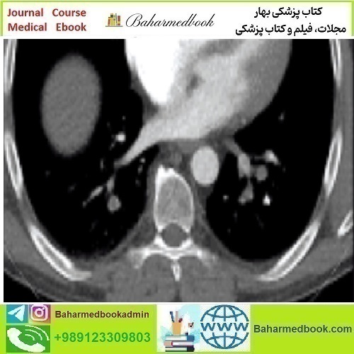 Clinical Cardiopulmonary Imaging Review 2019 video co