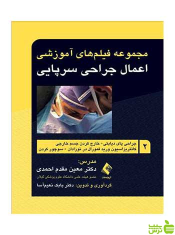اعمال جراحی سرپایی 2 جراحی پای دیابتی ارجمند - سیب ترش - SibTorsh