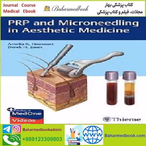 PRP and Microneedling in Aesthetic Medicine TRUE PDF price 1€