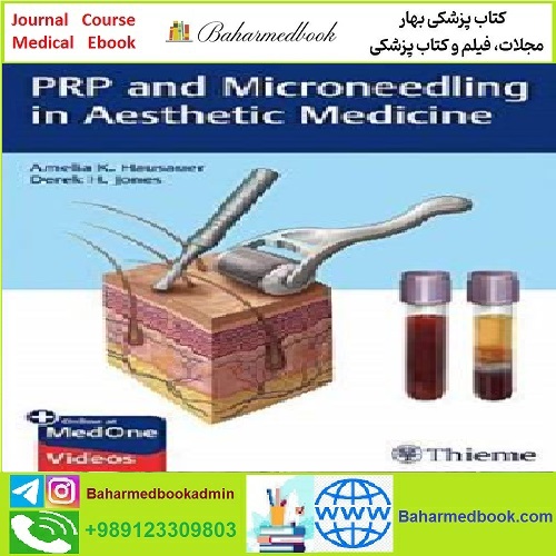 PRP and Microneedling in Aesthetic Medicine TRUE PDF price 1€