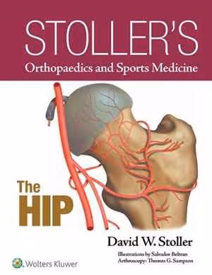 [EPUB] دانلود کتاب Stollers Orthopaedics And Sports Medicine - The Hip, 2018