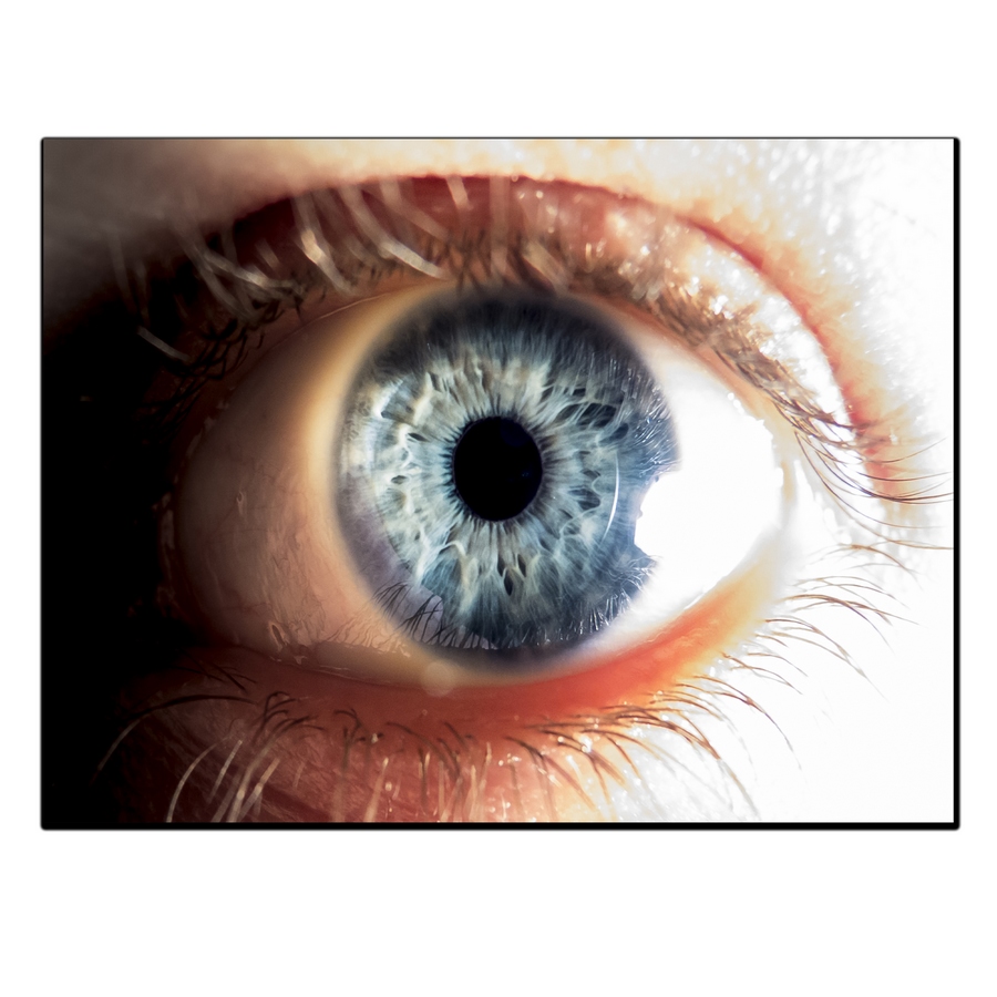 تابلو شاسی بکلیت طرح چشم پزشکی مدل SH-12512