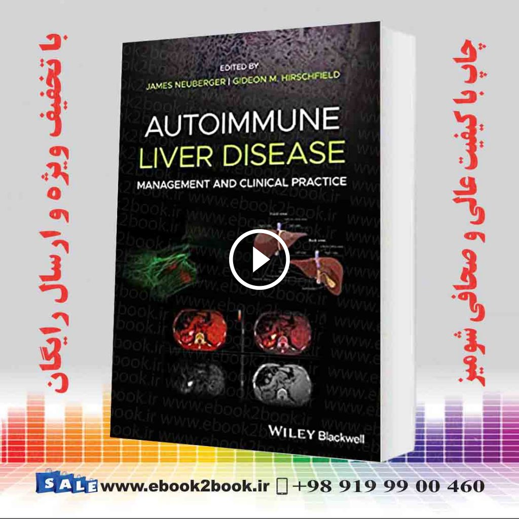 Autoimmune Liver Disease: Management and Clinical Practice