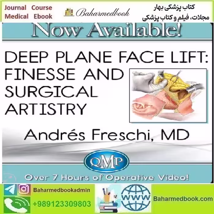 Deep Plane Face Lift Finesse and Surgical Artistry 2023 QMP vi