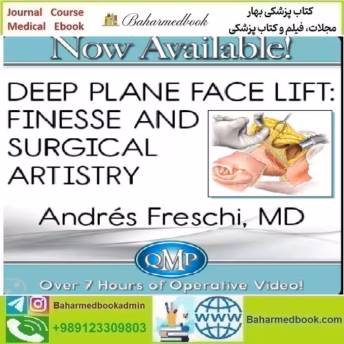 Deep Plane Face Lift Finesse and Surgical Artistry 2023 QMP vi