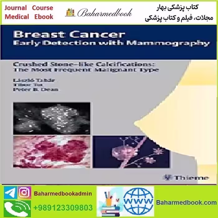 Breast Cancer Early Detection with Mammography TRUE PDF