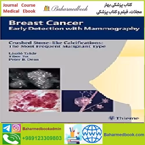 Breast Cancer Early Detection with Mammography TRUE PDF