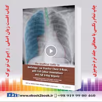 The Unofficial Guide to Radiology: 100 Practice Chest X Rays