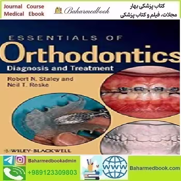 Essentials of Orthodontics Diagnosis and Treatment 2011