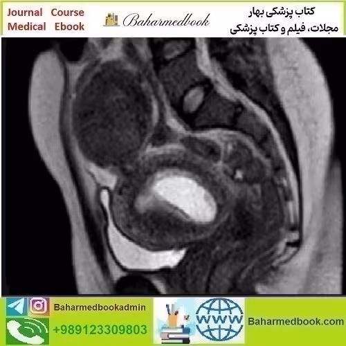 ARRS Abdominal MRI Practical Applications and Advan