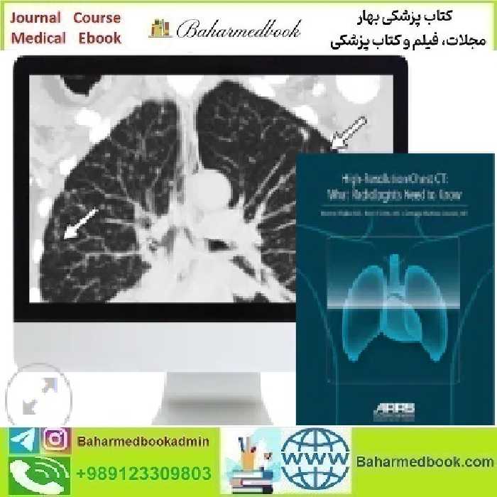 High Resolution Chest CT 2024 video course price 120€ - کتاب پزشکی بهار