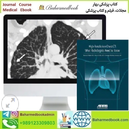 High Resolution Chest CT 2024 video course price 120€ - کتاب پزشکی بهار