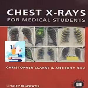 Chest X-rays for Medical Students TRUE PDF price 1€