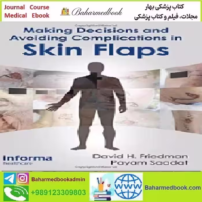 Making Decisions and Avoiding Complications in Skin Flaps T