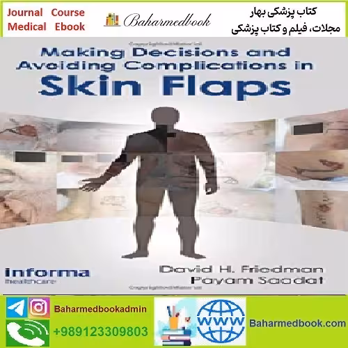 Making Decisions and Avoiding Complications in Skin Flaps T
