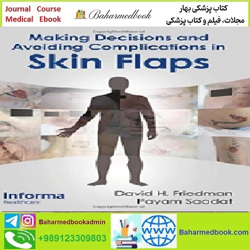 Making Decisions and Avoiding Complications in Skin Flaps T