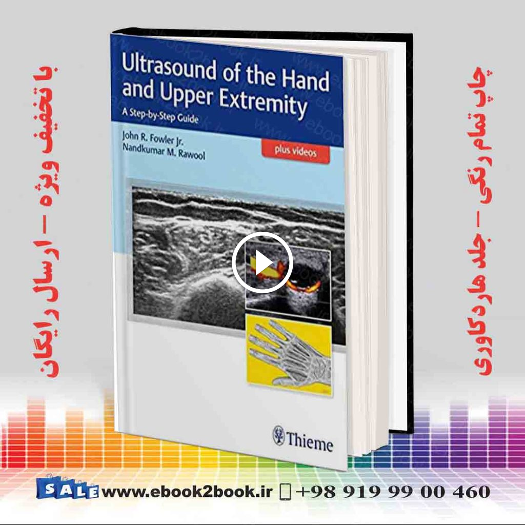 Ultrasound of the Hand and Upper Extremity