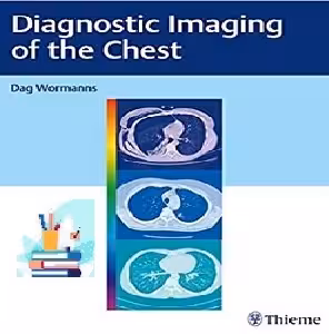 Diagnostic Imaging of the Chest TRUE PDF price 1€
