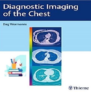 Diagnostic Imaging of the Chest TRUE PDF price 1€