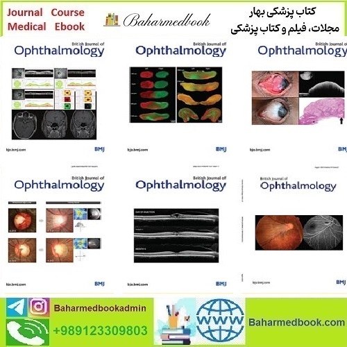 British Journal of Ophthalmology 2021-2024 Full Archives TRUE