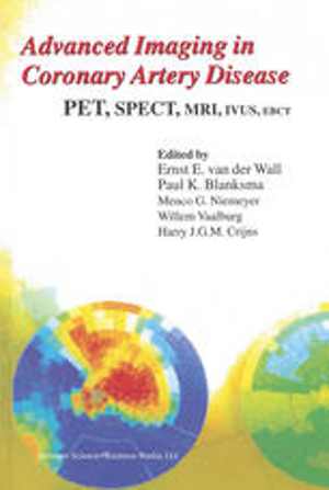 [PDF] دانلود کتاب Advanced Imaging In Coronary Artery Disease - Pet, Spect, Mri, Ivus, Ebct, 1998