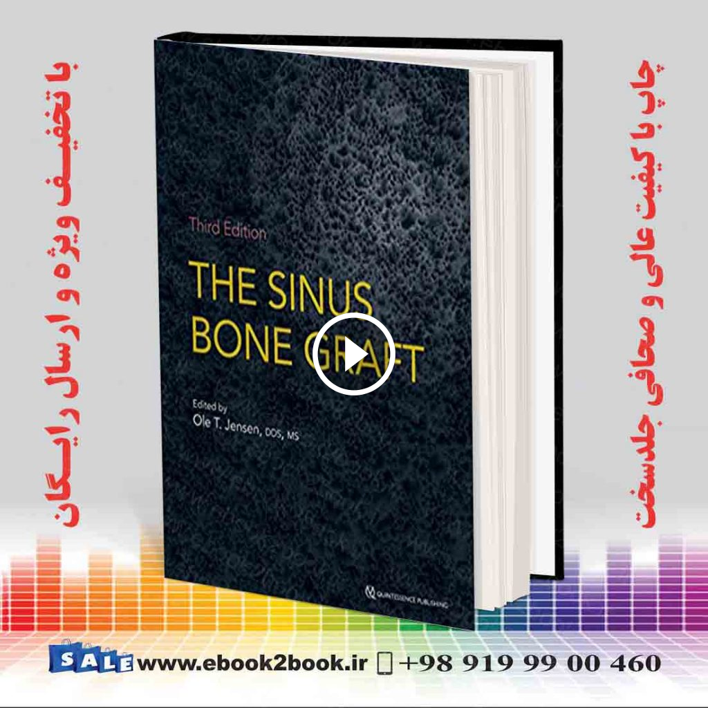 The Sinus Bone Graft 3rd Edition