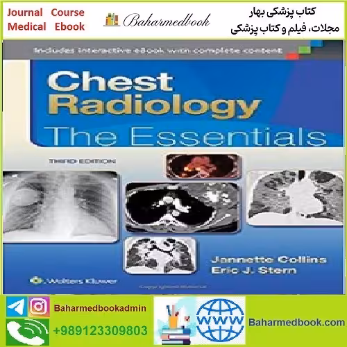 Chest Radiology The Essentials CONVERTEF PDF price 1€ - کتاب پزشکی بهار